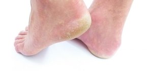 Diabetische Fußpflege von Stummer Fußgesundheit